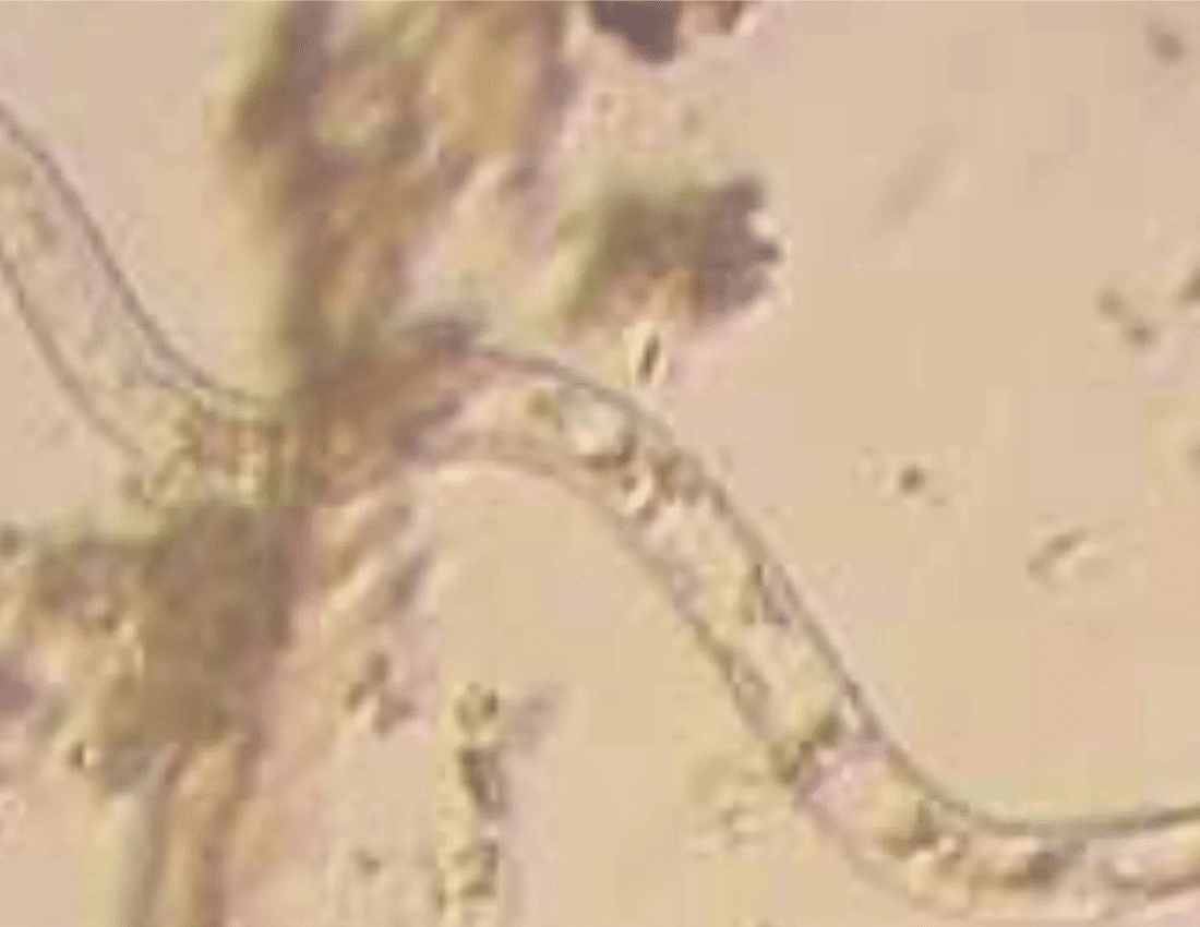 Worms