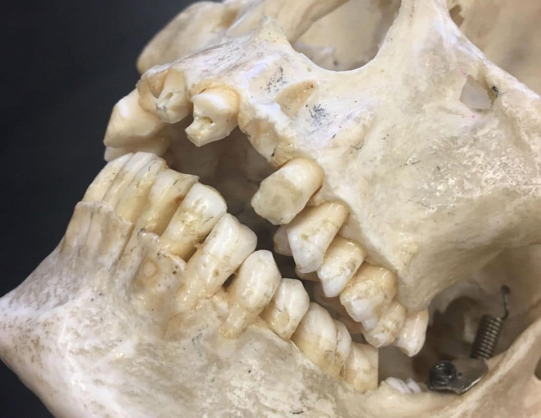 3d bones
