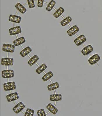 zooplankton
