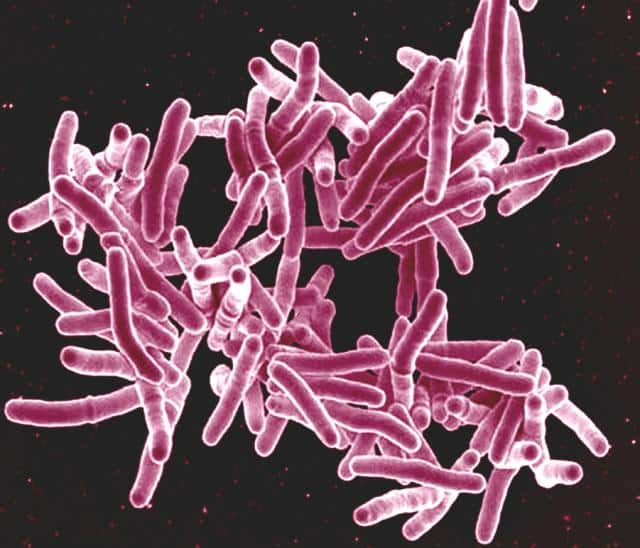Microbacillus Types of microbes: A comprehensive guide into the unseen world - Smore ...
