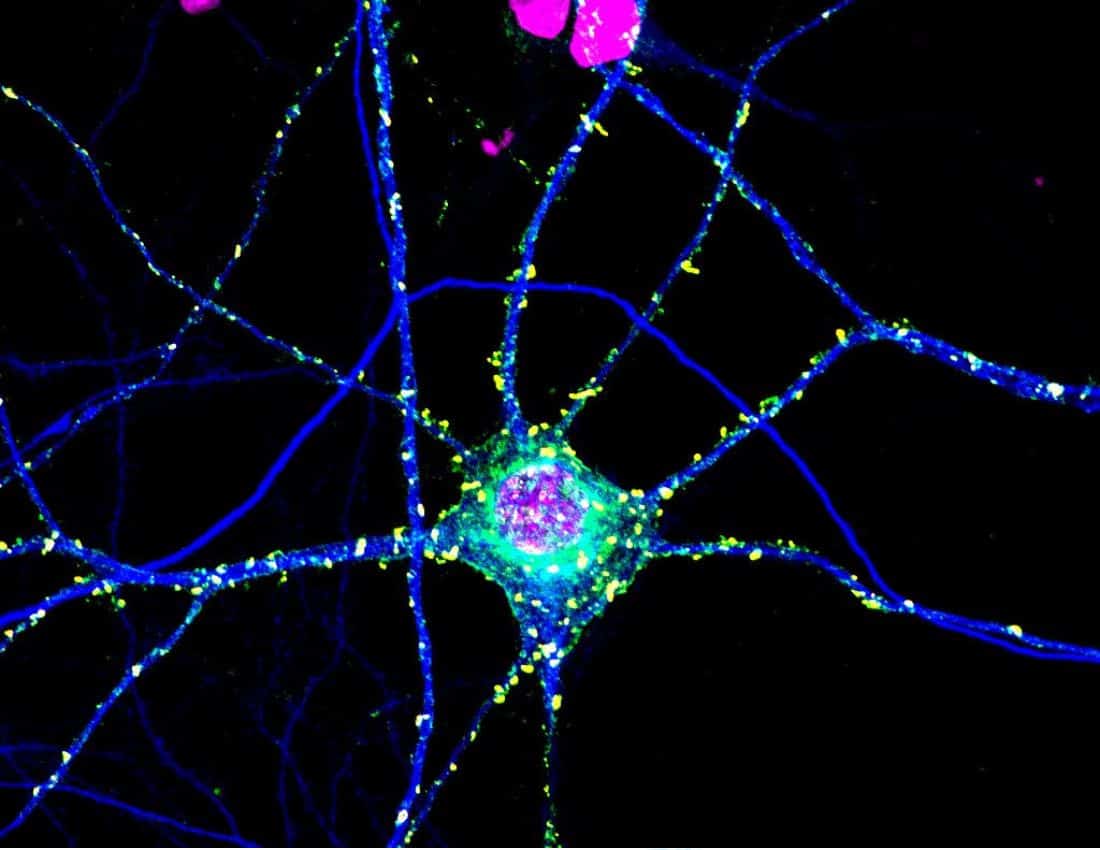 "Signaling in Neurons" by National Institutes of Health (NIH