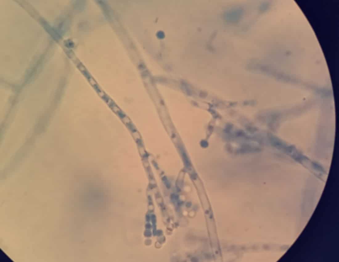 Penicillium notatum
