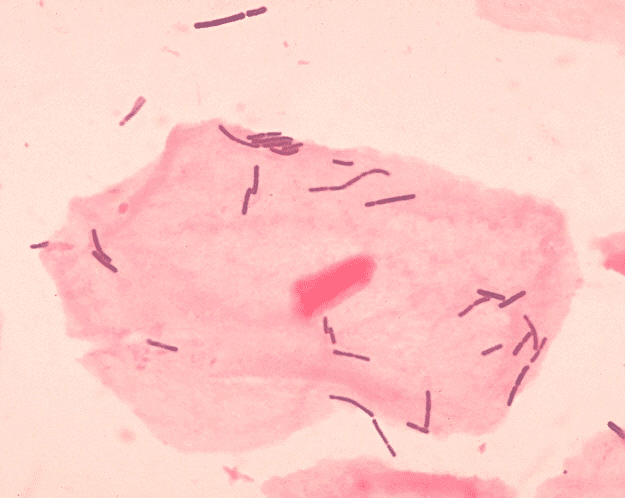 Lactobacilli are bacteria that live in the human gut