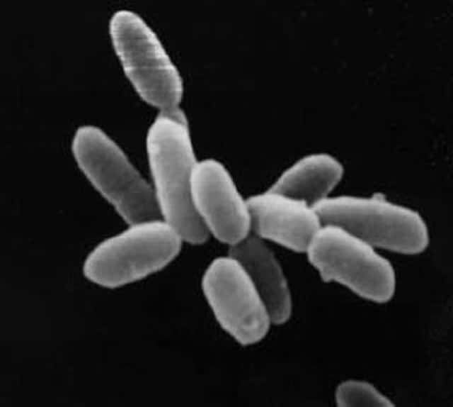 Single celled bacteria such as this halobacteria were amongst the first signs of life on earth.