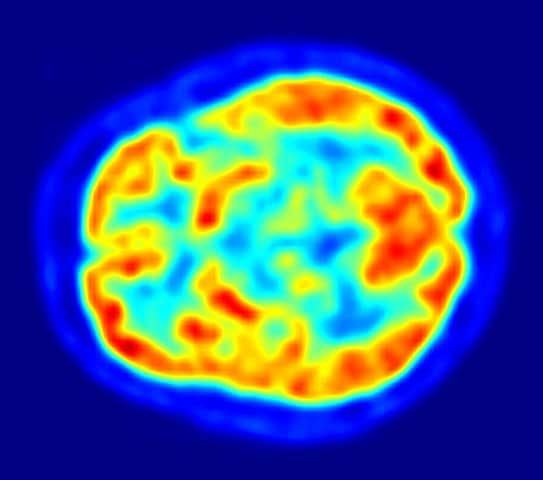 An image of the human brain showing energy consumption.