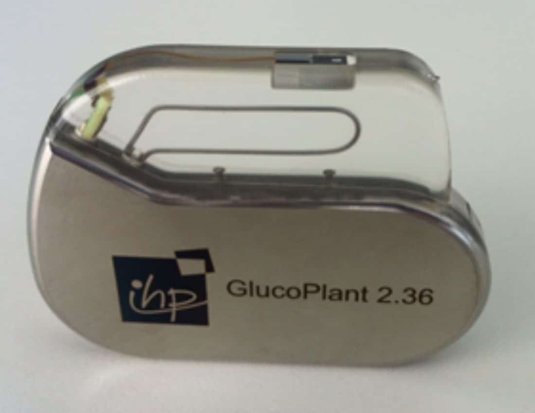 A glucose biosensor
