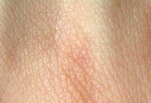 Your skin, like the soles of your shoes, contains grooves that bacteria can slide into to take off the pressure of getting stepped on.
