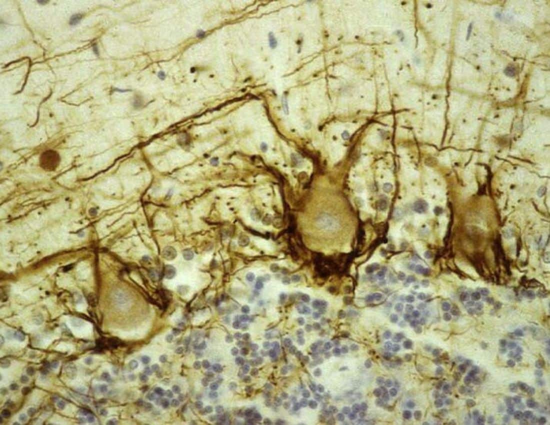 Brain Neurons