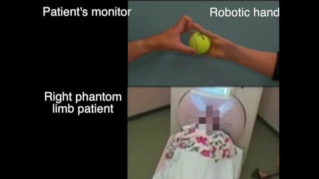 Induced-sensorimotor-brain-plasticity