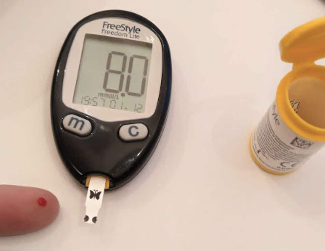 Monitoring of Blood Glucose