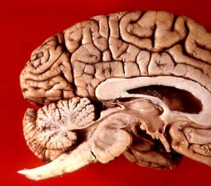 A close-up of a brain