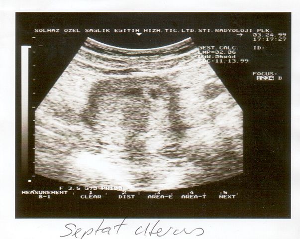 An ultrasound of a baby
Description automatically generated