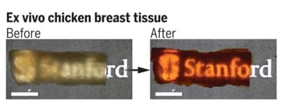 Breast tissue