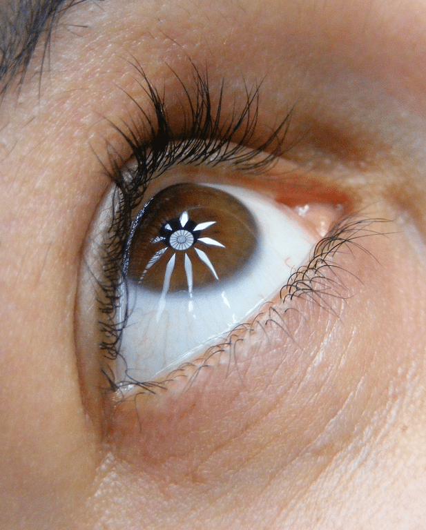 vision