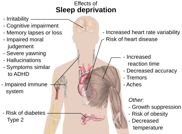 Effects_of_sleep_deprivation.svg