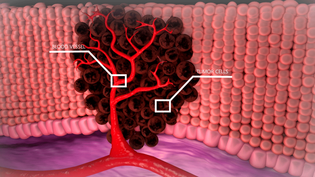 Tumor_Cells