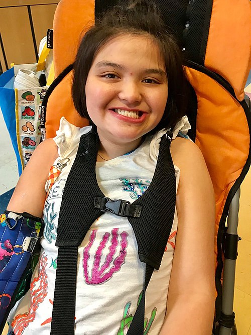Rett Girl Smiling