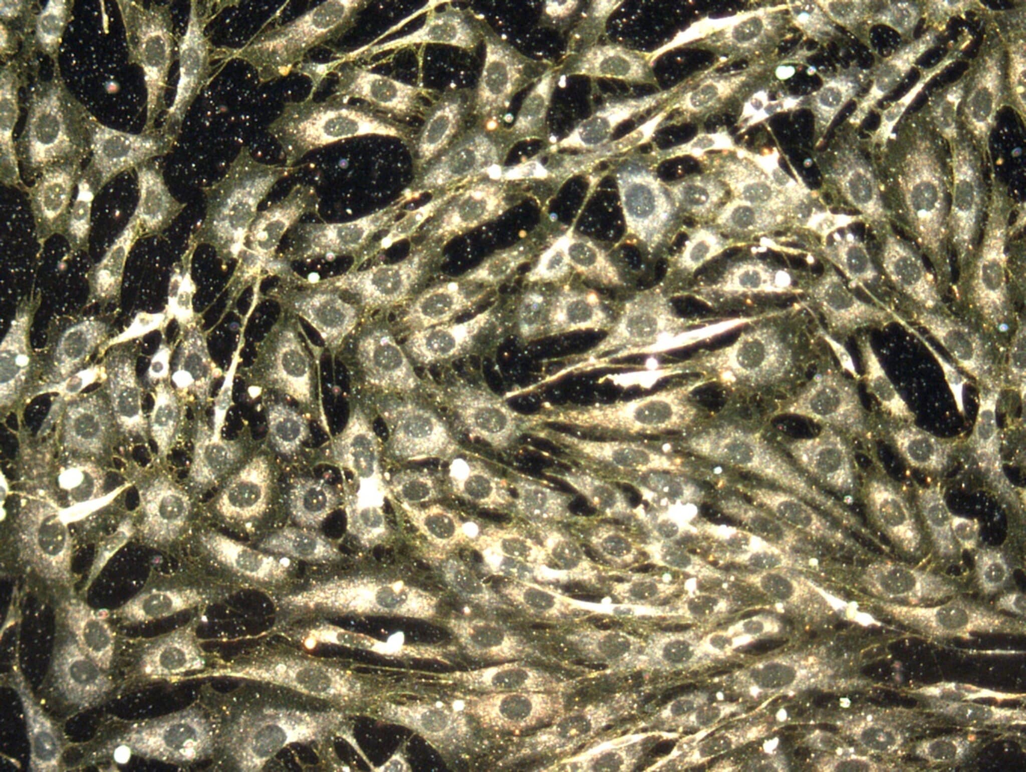 Gold Nanoparticles in Cell Cytosol