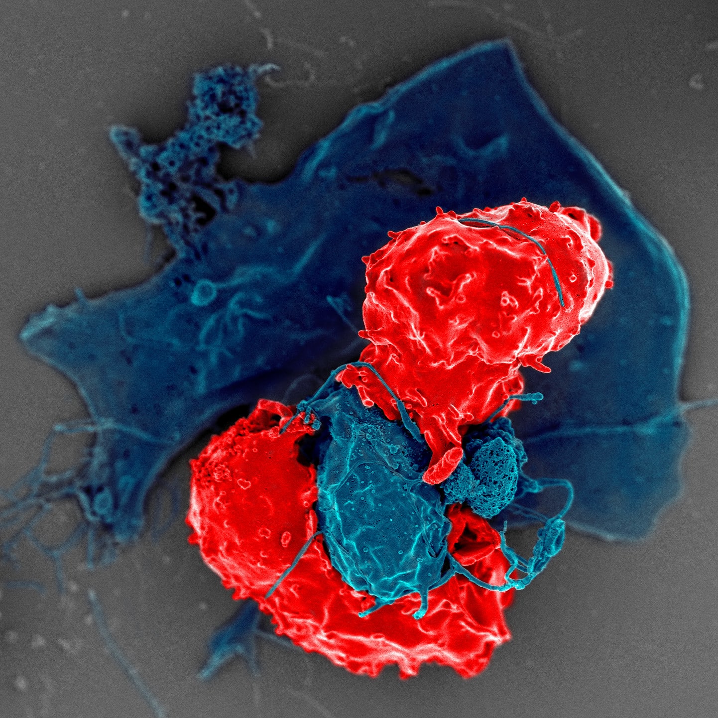 Regulatory T cells