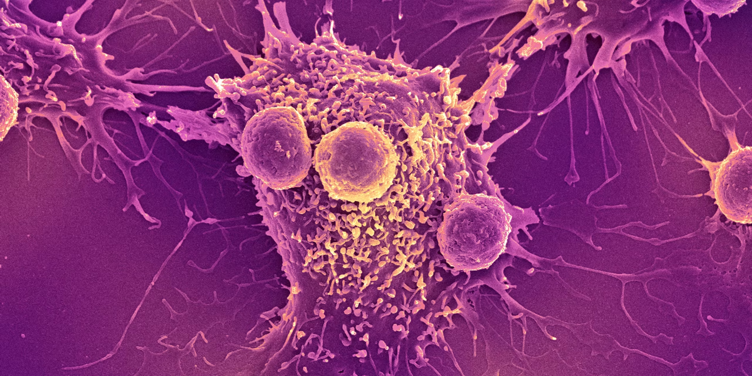 With a little help, your immune cells can be potent tumor killers