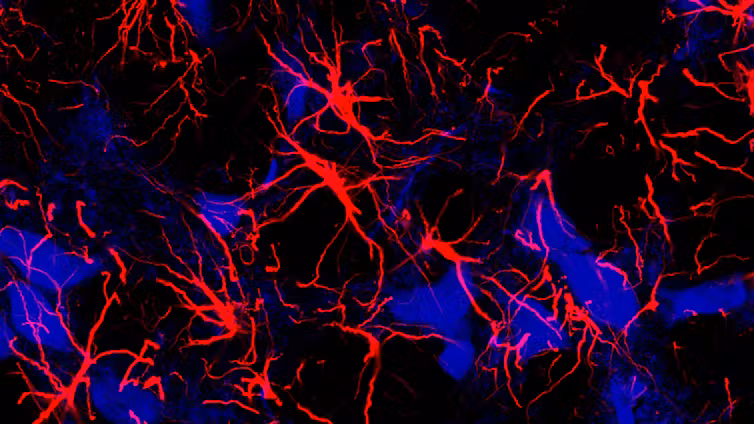 Astrocytes