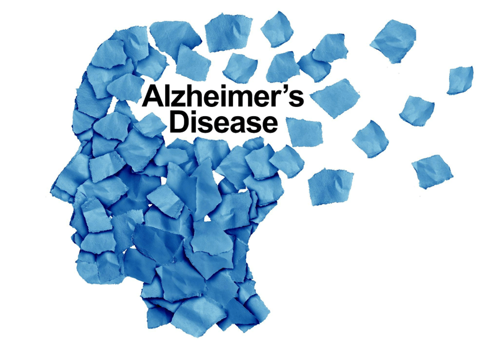 Alzheimer