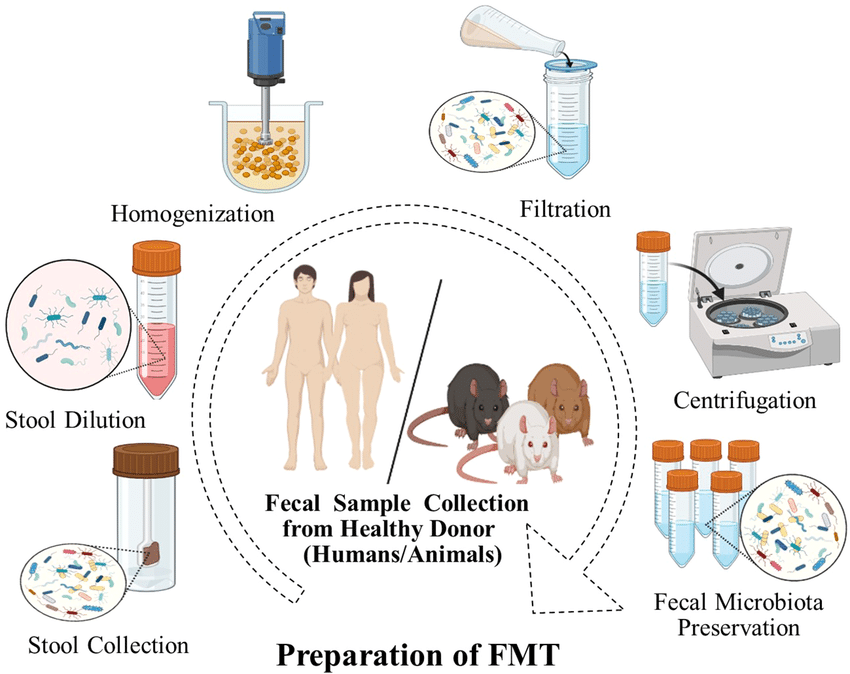 Flowchart representation of preparing FMT