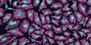 HeLa cells