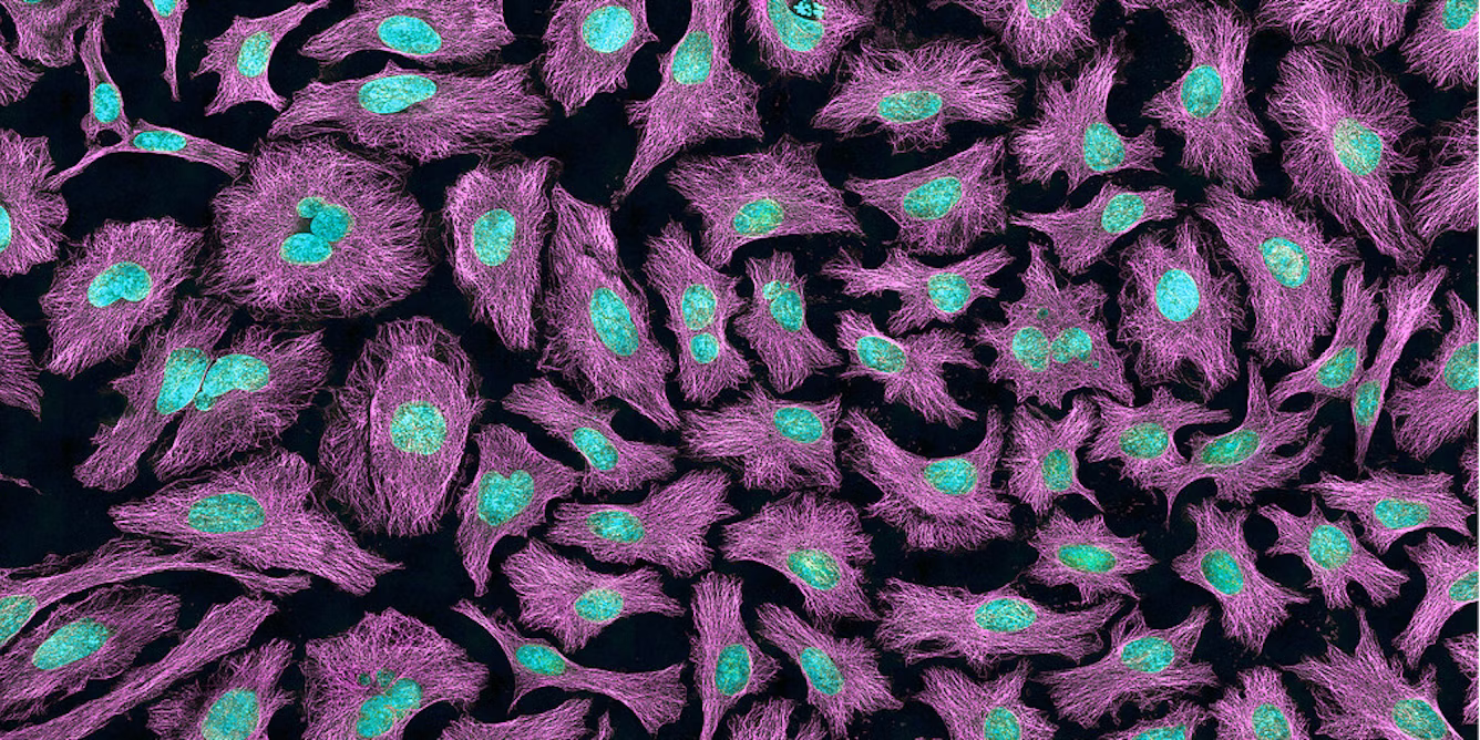 HeLa cells