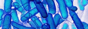E. coli uses