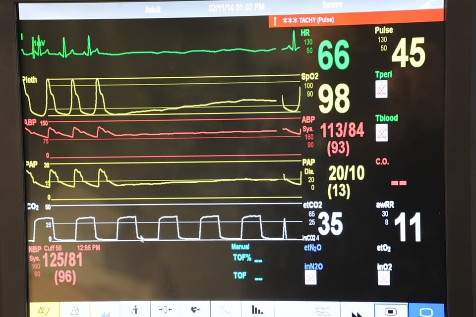Vital signs monitor display
